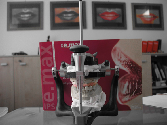 studio odontotecnico ZenoDental