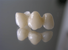 Protesi Metal Free Zirconio Ceramica